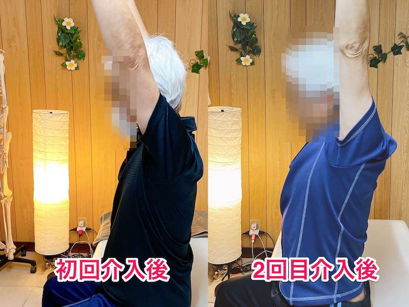 北区王子整体サロンてぃ〜だに来院された五十肩でお悩みの50代男性