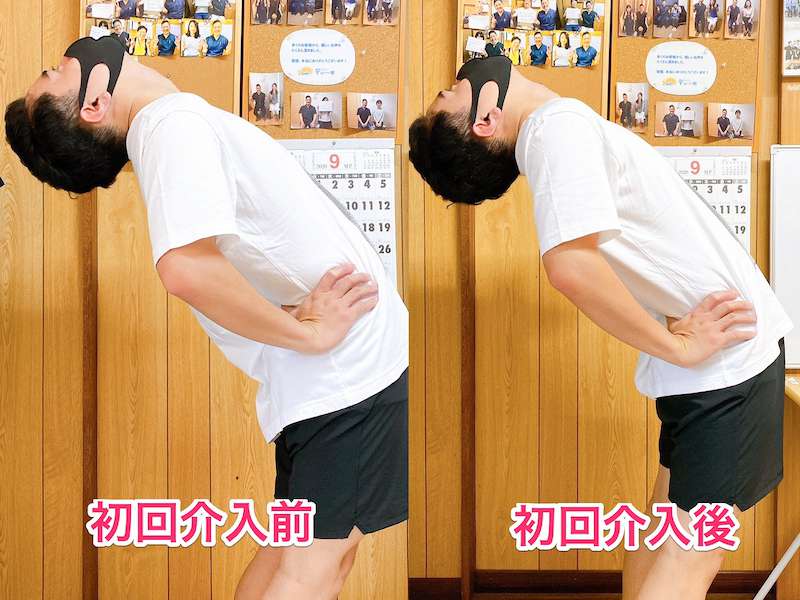 北区王子整体サロンてぃ〜だに来院された坐骨神経痛でお悩みの20代男性