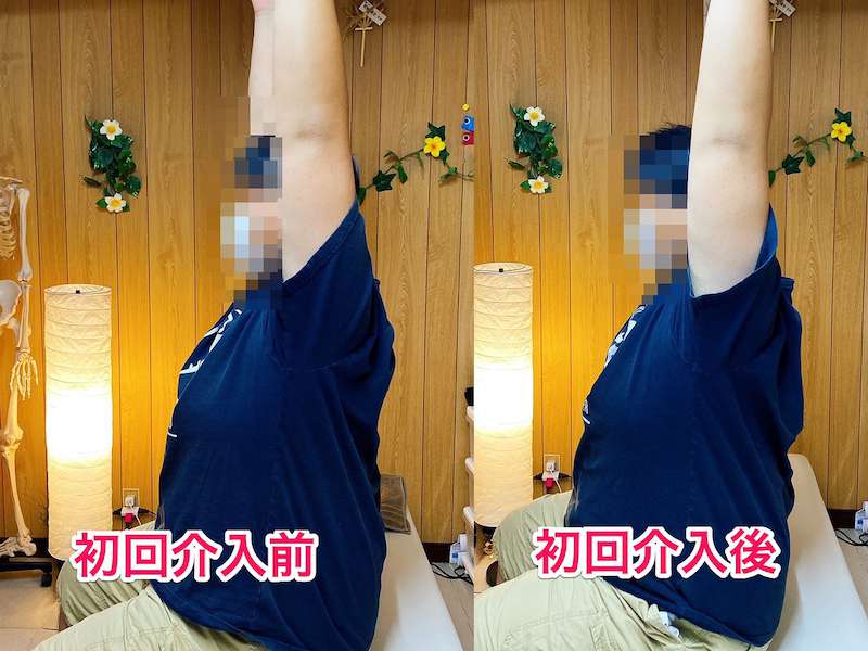 北区王子整体サロンてぃ〜だに来院された肩の痛みでお悩みの30代男性