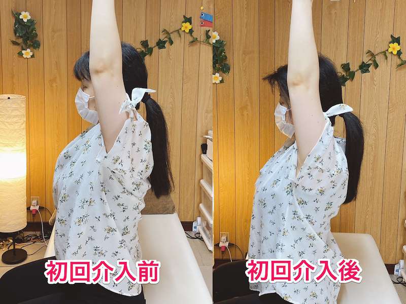 北区王子整体サロンてぃ〜だに来院された肩の痛みでお悩みの30代女性