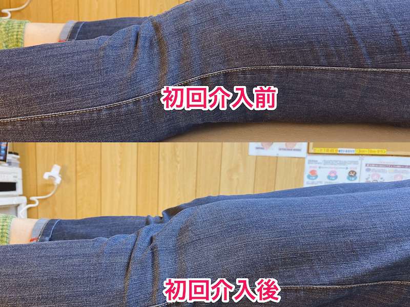 北区王子整体サロンてぃ〜だに来院された変形性膝関節症でお悩みの60代女性