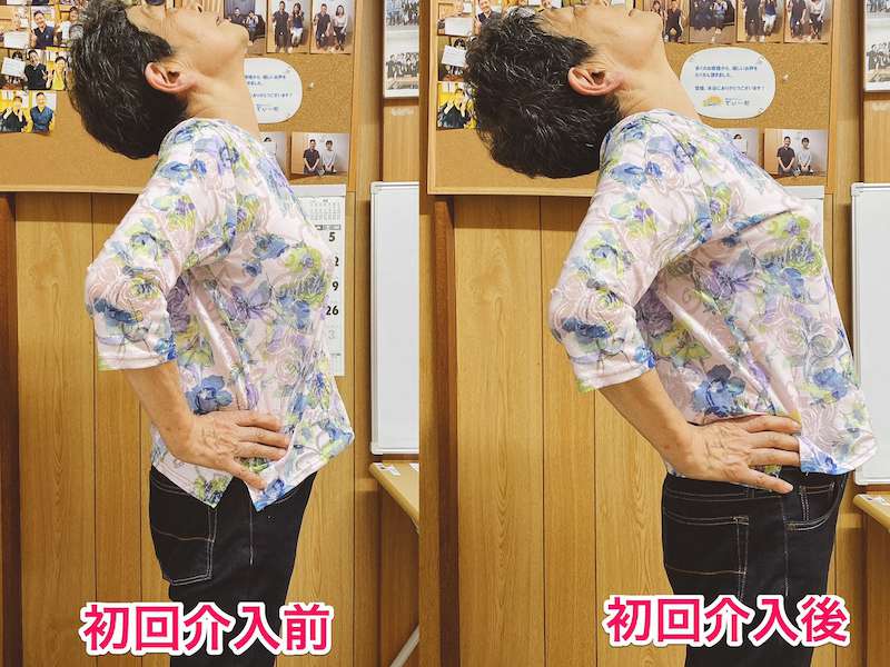 北区王子整体サロンてぃ〜だに来院された腰部脊柱管狭窄症でお悩みの80代女性