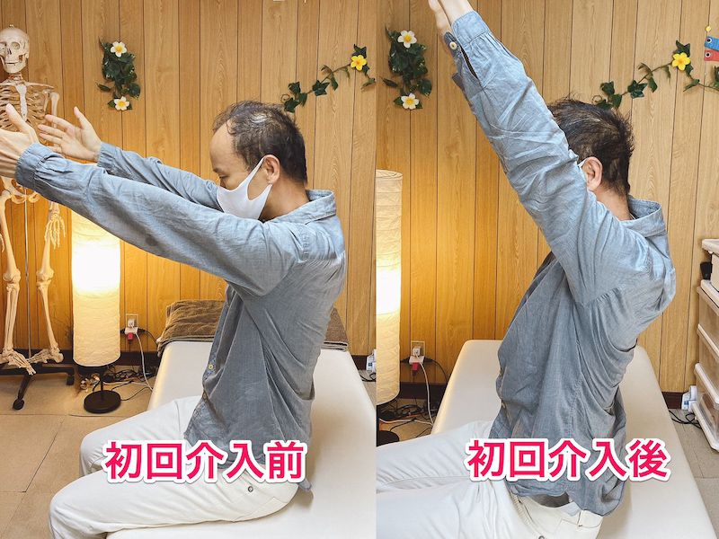 北区王子整体サロンてぃ〜だに来院された肩の痛みでお悩みの50代男性