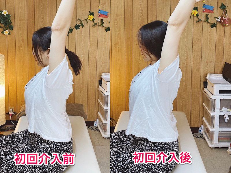 北区王子整体サロンてぃ〜だに来院された肩の痛みでお悩みの30代女性