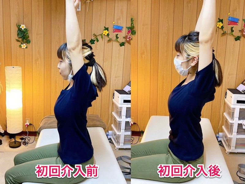 北区王子整体サロンてぃ〜だに来院された肩の痛みでお悩みの30代女性
