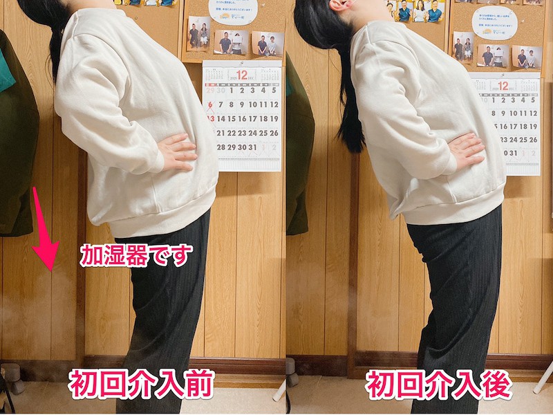 北区王子整体サロンてぃ〜だに来院された腰椎椎間板ヘルニアでお悩みの50代女性